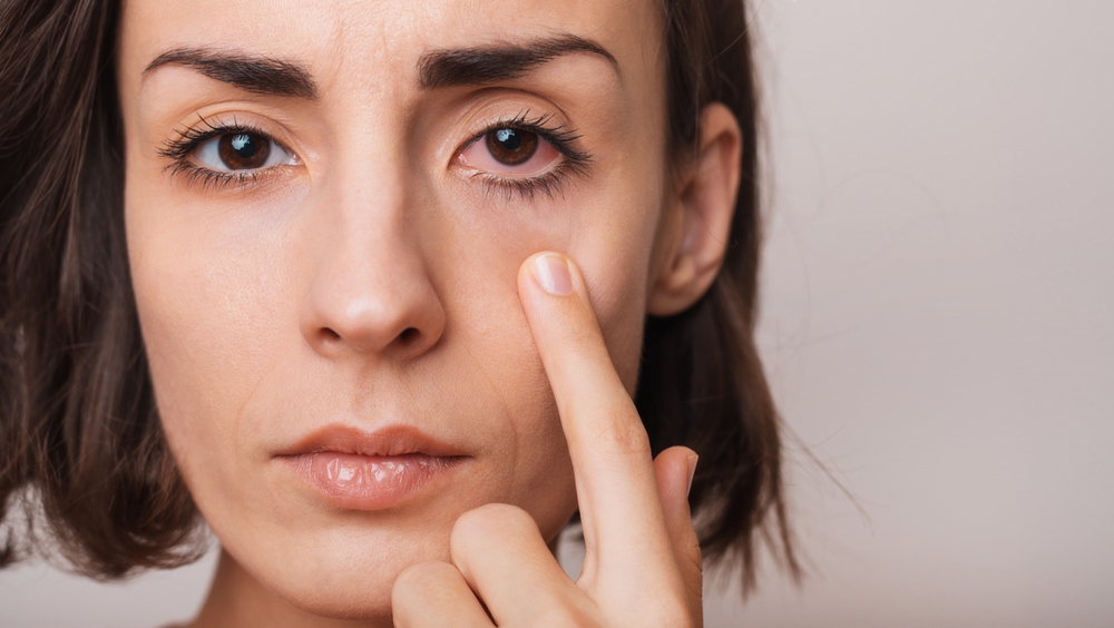 How Can Lifestyle Choices Contribute to Chronic Dry Eye?